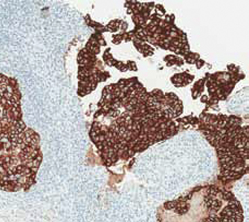 ePathology scanned pathology slide image