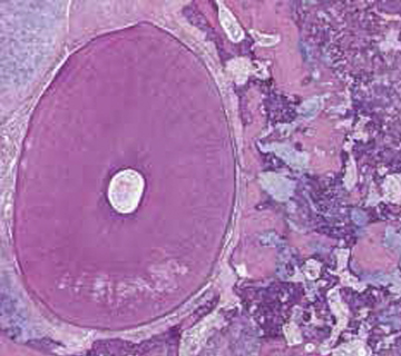 ePathology scanned pathology slide image